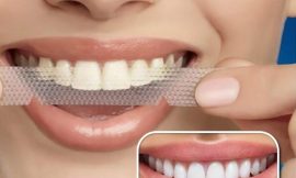 Tips for Post-Whitening Care with Crest Teeth Whitening Strips