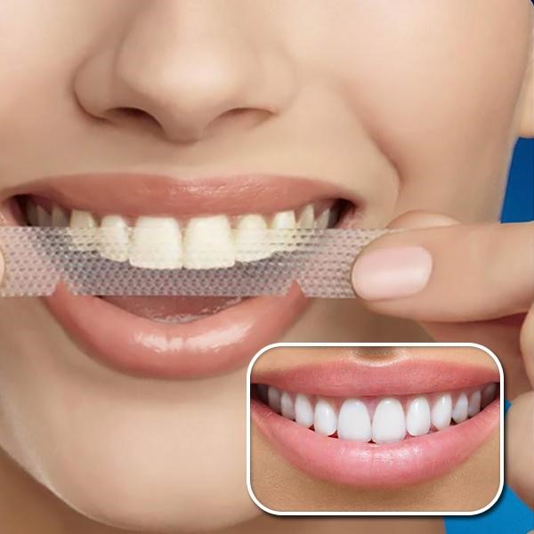 Crest Teeth Whitening Strips