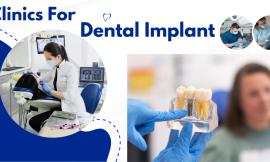 5 Top Rated Clinics For Dental Implant in Singapore 