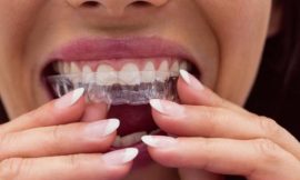 How Invisalign Can Improve Your Confidence and Smile