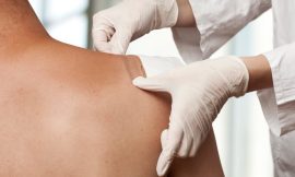 Lipoma Treatment: Your Questions Answered