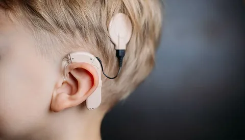 Cochlear Implant Surgery