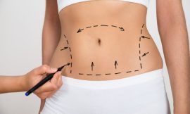 What You Need to Know About Travel Considerations After Liposuction in Dubai