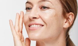 How to Maintain Your Skin Post-Melasma Treatment