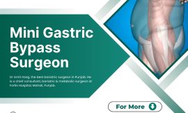 Mini Gastric Bypass Surgery: A Comprehensive Guide to a Less Invasive Weight Loss Solution