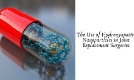 The Use of Hydroxyapatite Nanoparticles in Joint Replacement Surgeries