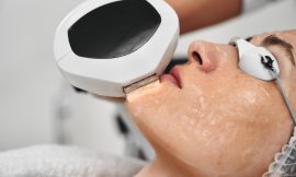 Laser Acne Treatment: The Key to Acne-Free Skin