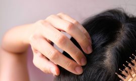 Understanding Finasteride: A Comprehensive Guide for Hair Loss