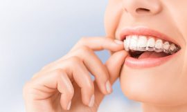 Can You Get Discounts on Invisalign Braces Treatment Cost in Dubai?