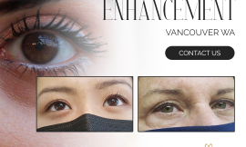 Lash Enhancement: Elevate Your Eye Game