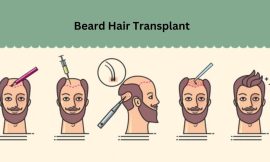 Beard Hair Transplant: Your Path to a Fuller Beard