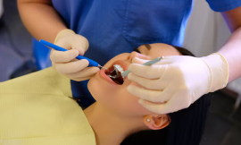 Why Dental Crowns in Somerville Are the Solution You Need