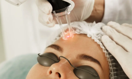 The Real Cost of Fractional CO2 Laser Treatments in Dubai: A Patient’s Guide