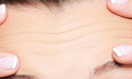 Forehead Reduction Surgery: Discover Your Best Self