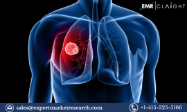 Lung Cancer Screening Market: Trends, Key Players, and Future Outlook 2032