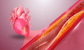 Exploring the Growth and Innovation in the Acute Coronary Syndrome Treatment Market