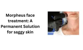 Morpheus Face Treatment: A Permanent Solution for Saggy Skin