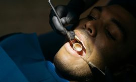 The Benefits of Dental Crowns: Why Medford Residents Choose Them