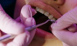 Preventing Dental Emergencies: Tips from Laguna Niguel Dentists