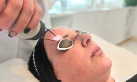 Maximizing Results: Preparing for Your Pico Laser Treatment