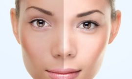 The Benefits of Permanent Skin Whitening Treatments in Dubai