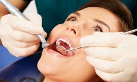 Saving Your Smile: A Guide to Root Canal Treatment in Dubai