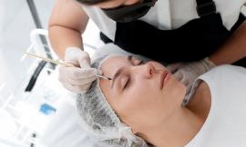 Unlock Radiant Skin: Why Microneedling is a Must-Try in Nottingham