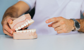 Real Patient Experiences: Transforming Smiles with CU SIL Partial Dentures