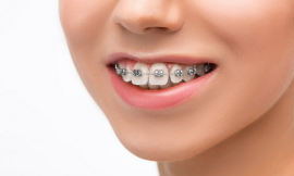 How to Choose an Orthodontist Near You: Tips for Finding the Right Fit