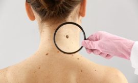 How to Remove Skin Tags on Inner Thigh: A Complete Overview