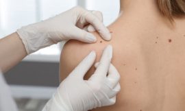 Uncovering the Advantages of Skin Tag Removal Procedures in Dubai