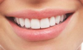 From Dull to Dazzling: Effective Teeth Whitening Methods Revealed