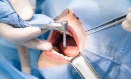 The Future of Dentistry: Innovations in Dental Implants