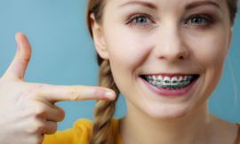 How Metal Braces Work: The Science Behind Smiles