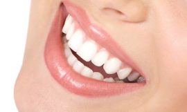 Teeth Whitening for Sensitive Teeth: Safe Options for Everyone