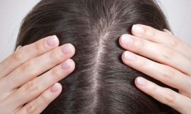 FUE Hair Transplants: The Answer to Hair Loss