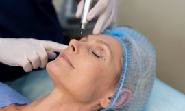 Everything You Need to Know About Skin Tightening Treatments