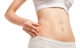 Liposuction and Infection: Preventing Complications