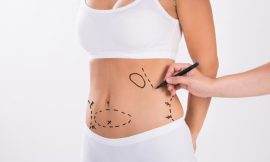 Debunking Liposuction Myths: Separating Fact from Fiction