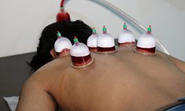 How Hijama Cupping Enhances Blood Flow