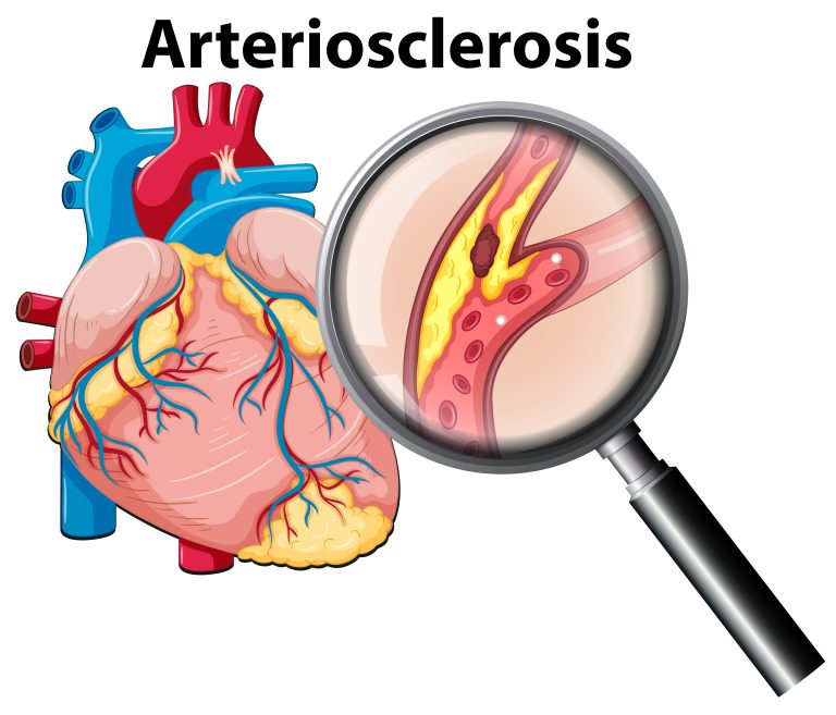 Read more about the article Heart Tumor Treatment in India – An Easy Guide for Students