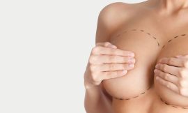 Breast Augmentation Preparation Tips for Dubai’s Residents