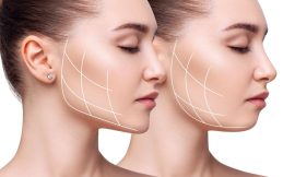 Facial Rejuvenation Explained: Procedures, Costs, and Results