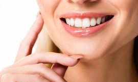 Beyond Aesthetics The Functional Benefits of Composite Veneers