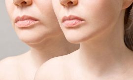 Why Is Facial Rejuvenation So Popular?