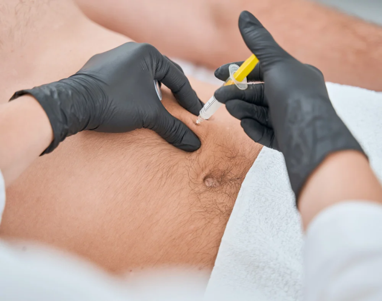 Read more about the article How Popular Are Fat Injections in Dubai Among Locals?