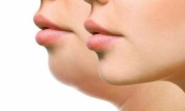 Texas Jawline Fillers Treatments in Dubai: Benefits and Results