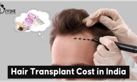 Does a hair transplant come under mediclaim?