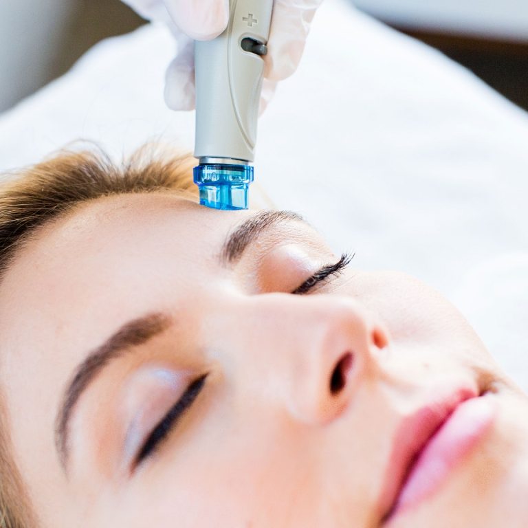 Read more about the article HydraFacial: The Best Way to Treat Acne Scars