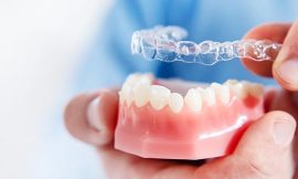 Top Reasons to Invest in Dental Retainers in Dubai